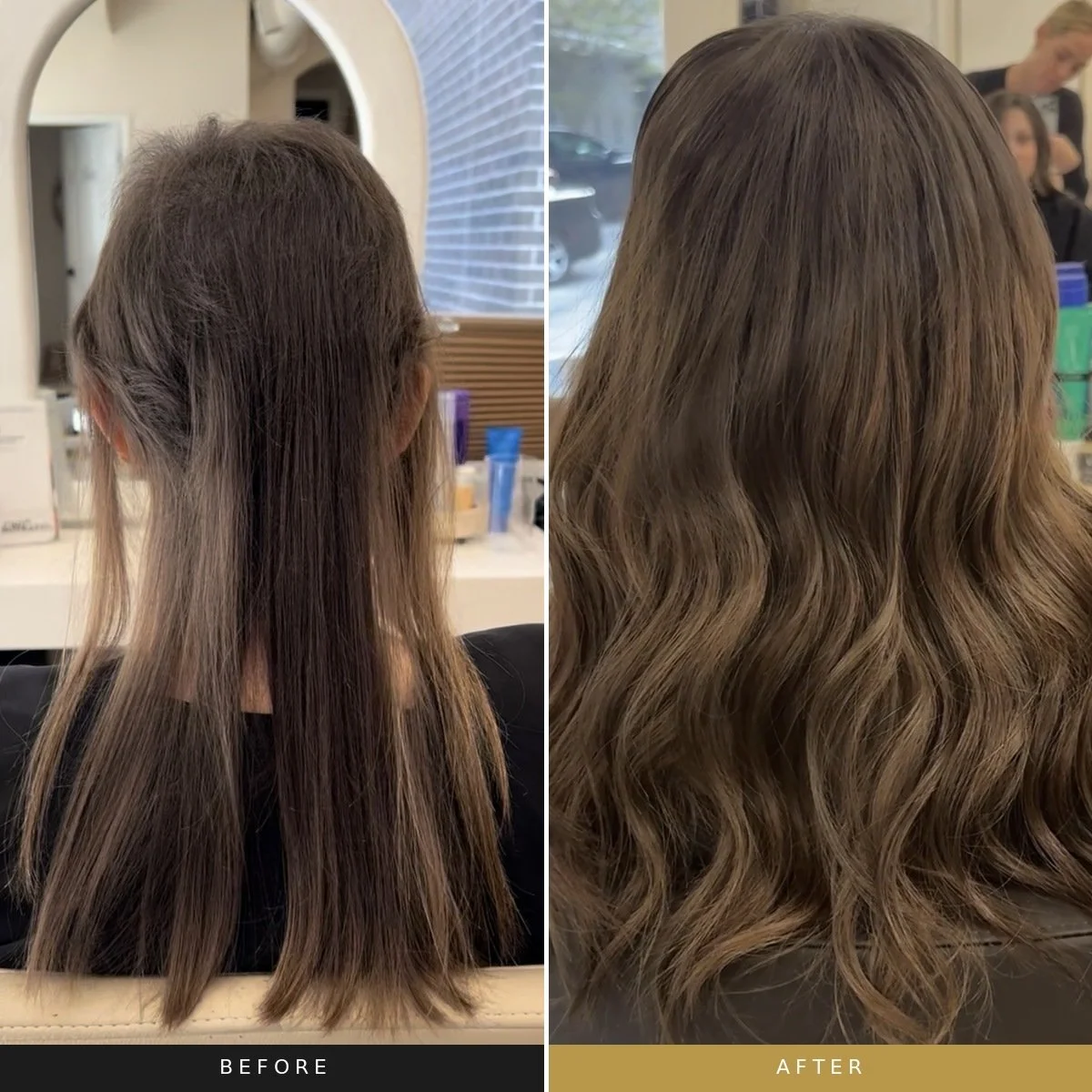 Before and after AlmaTED® hair restoration treatment showing improved hair density and reduced scalp visibility.