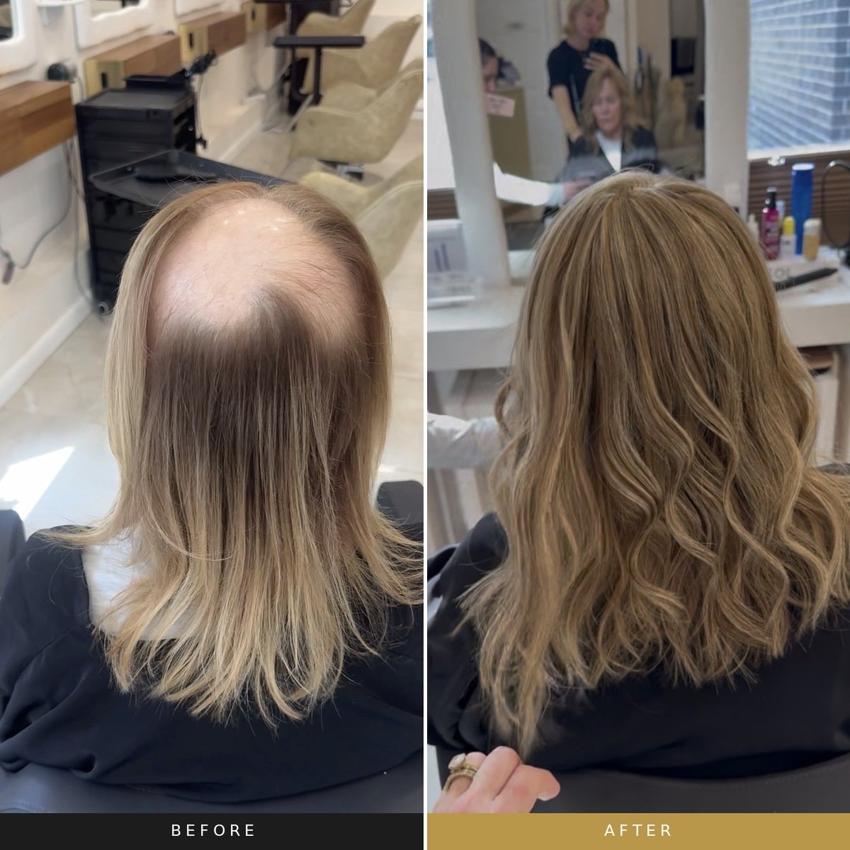 custom hair topper before and after crown thinning Atlanta