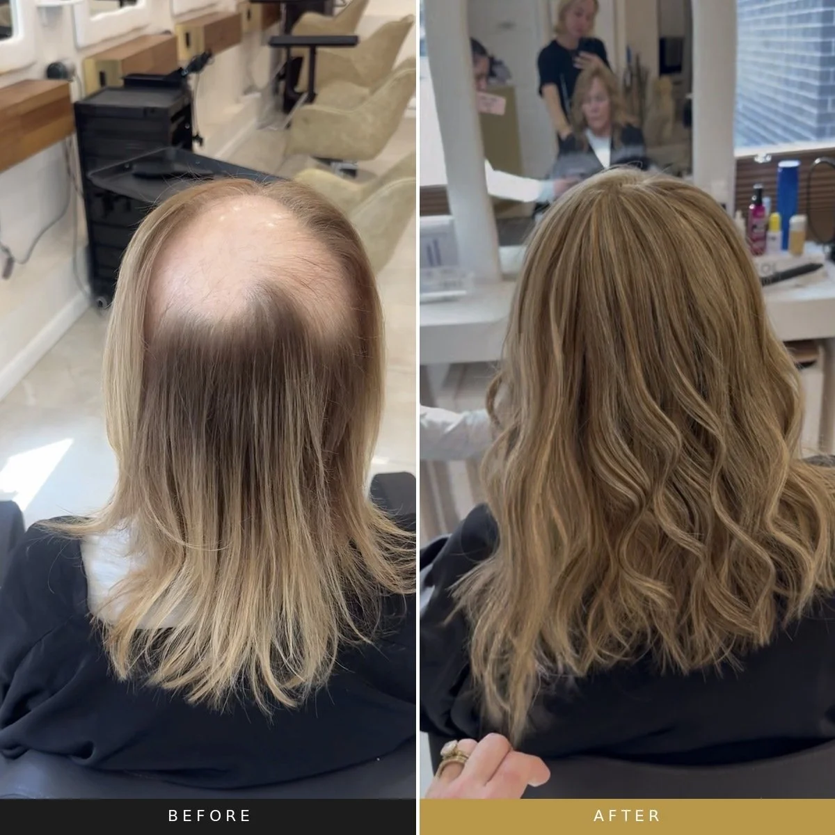 Before and after custom hair topper transformation for crown thinning and female hair loss.