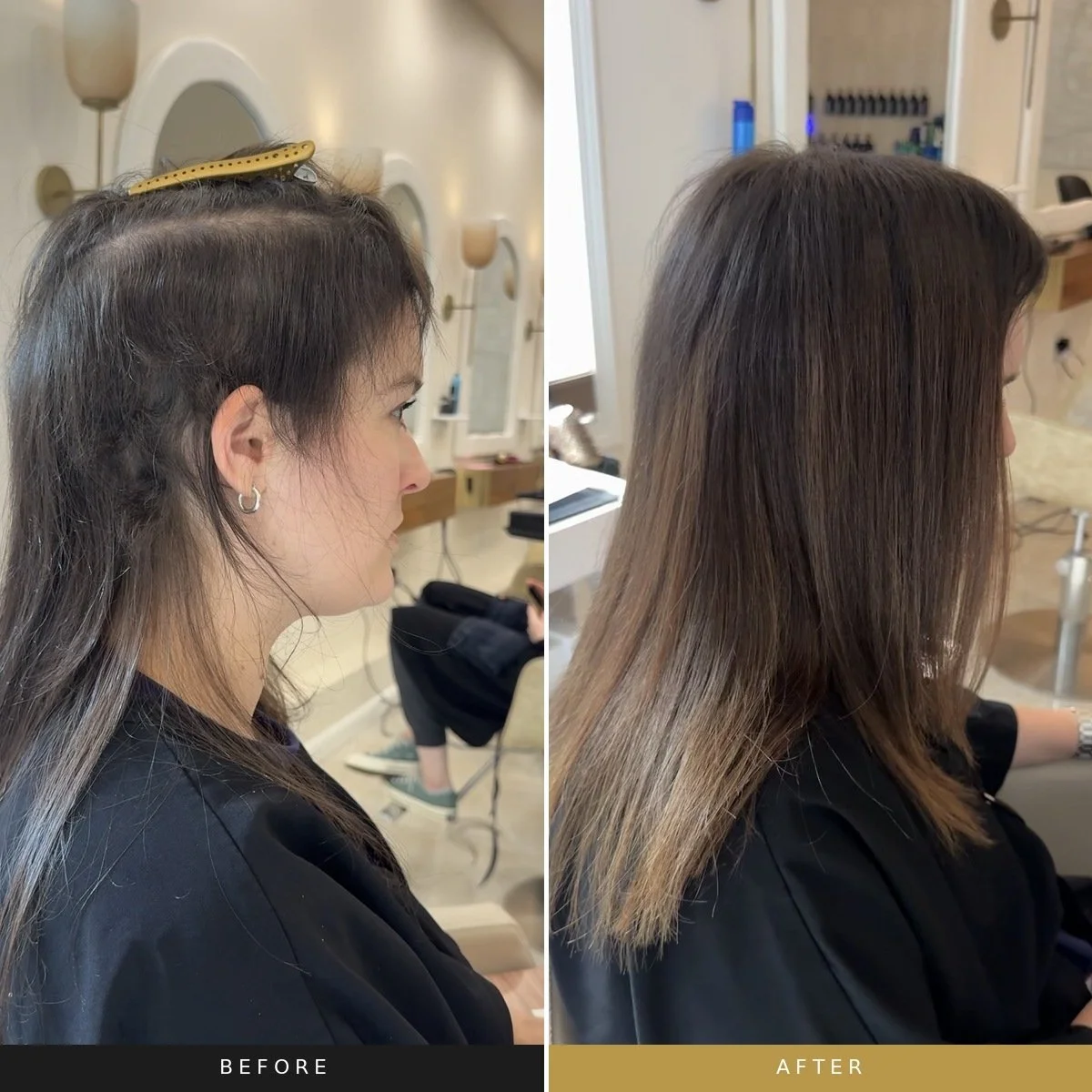Before and after mesh integration transformation for alopecia and advanced hair loss.