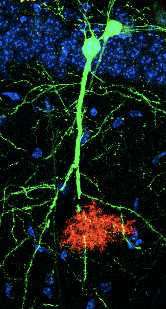 Image of interactions between learning-associated astrocytes and engram neurons.