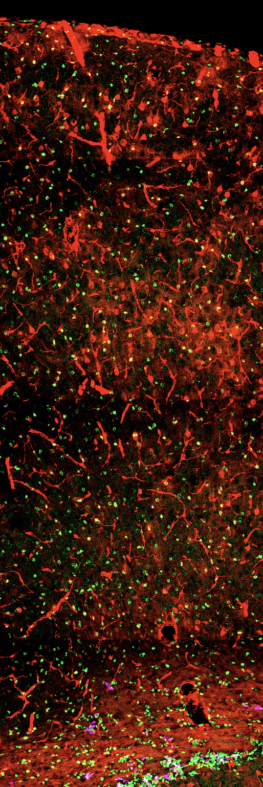 Astrocyte heterogeneity in the developing cortex.