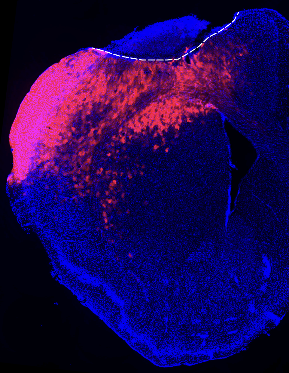 Viral labeling of astrocytes surrounding a stroke