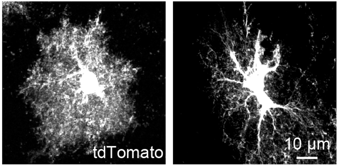 Astrocyte morphology in health and disease