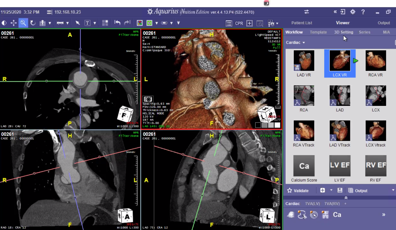 Cardiac CT Level 2 Course (Bangkok)