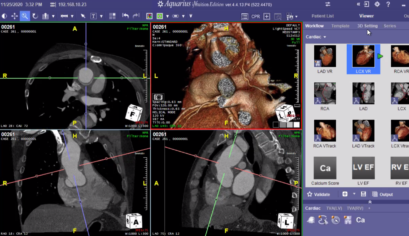 Cardiac+CT+in+action.png