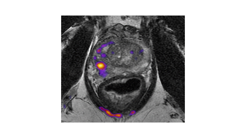 Abdominal and Chest Imaging (Hands-on) Workshop