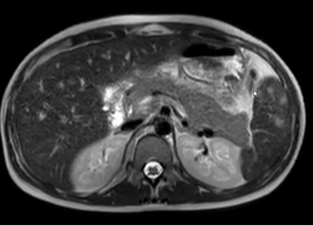 Abdominal and Chest Imaging (Hands-on) Workshop