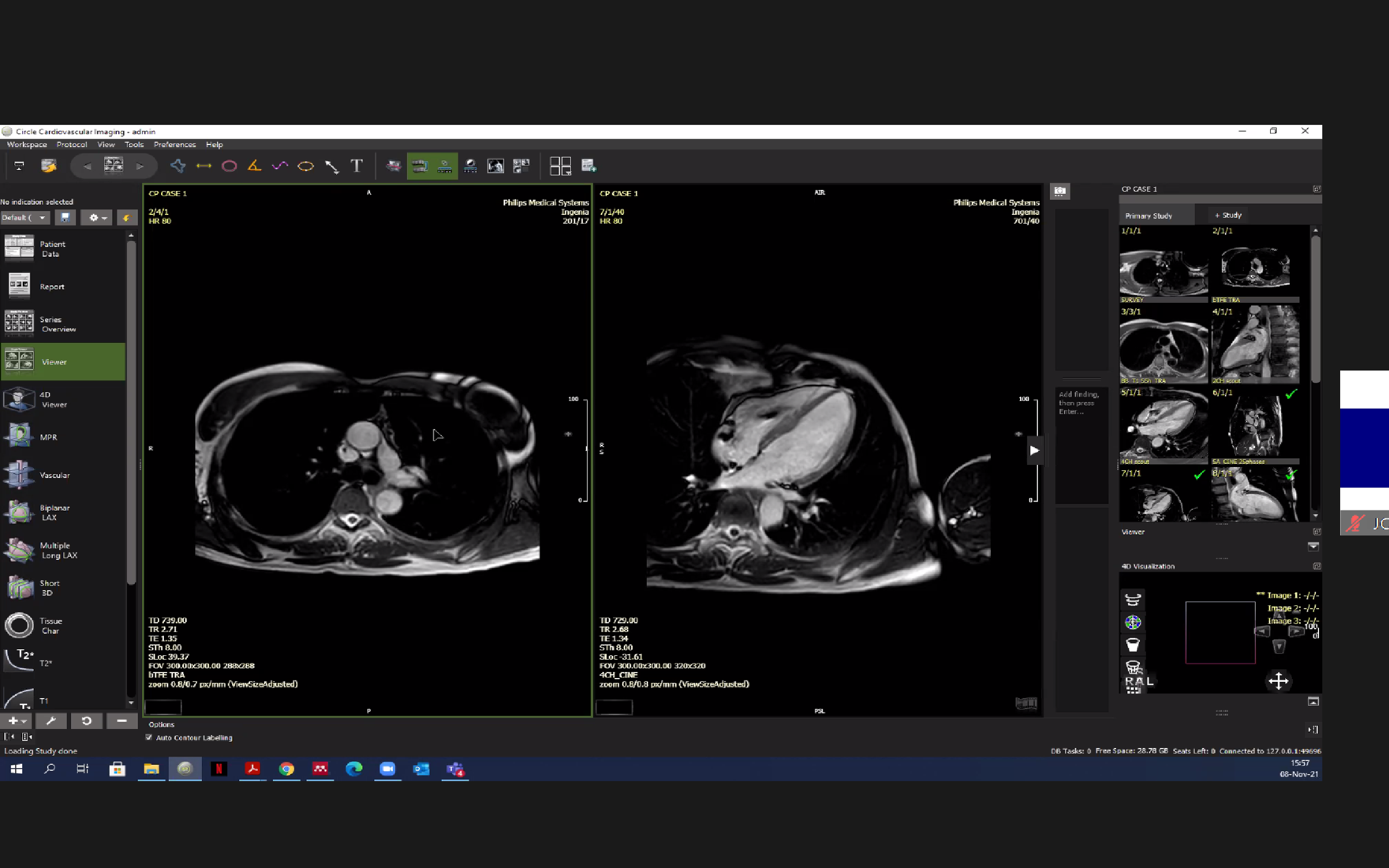 Cardiac MRI Course (Level 1 SCMR Endorsed)