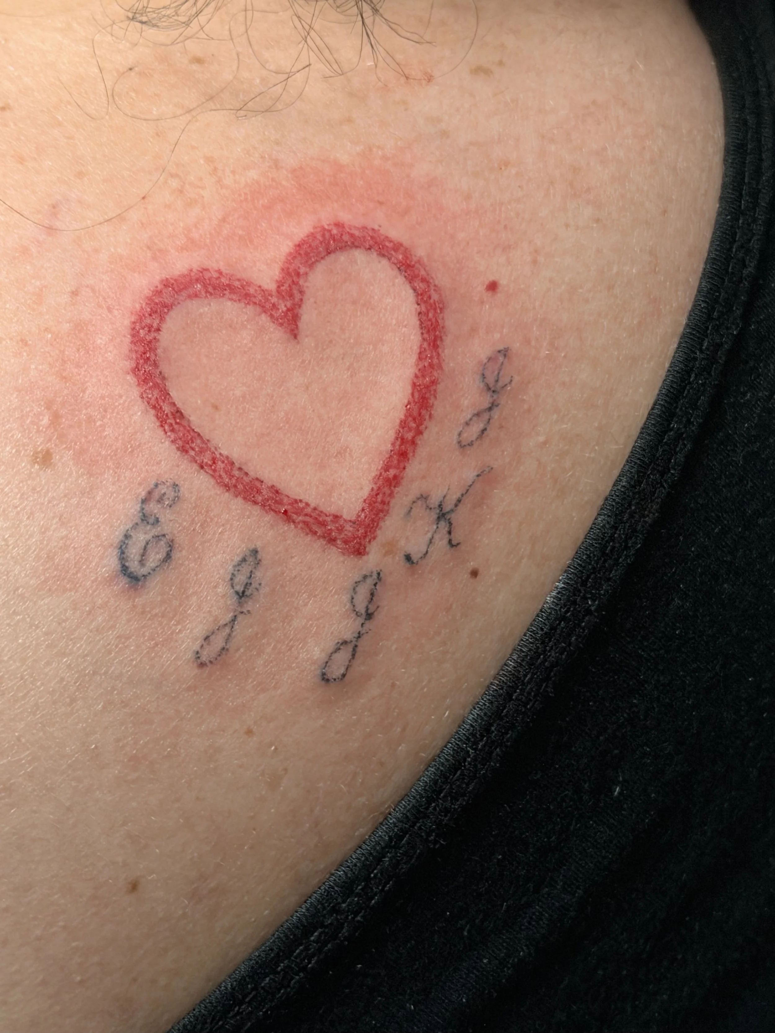 Close-up of a person's skin with a red heart-shaped outline drawn on it, along with some words written underneath, partially visible.