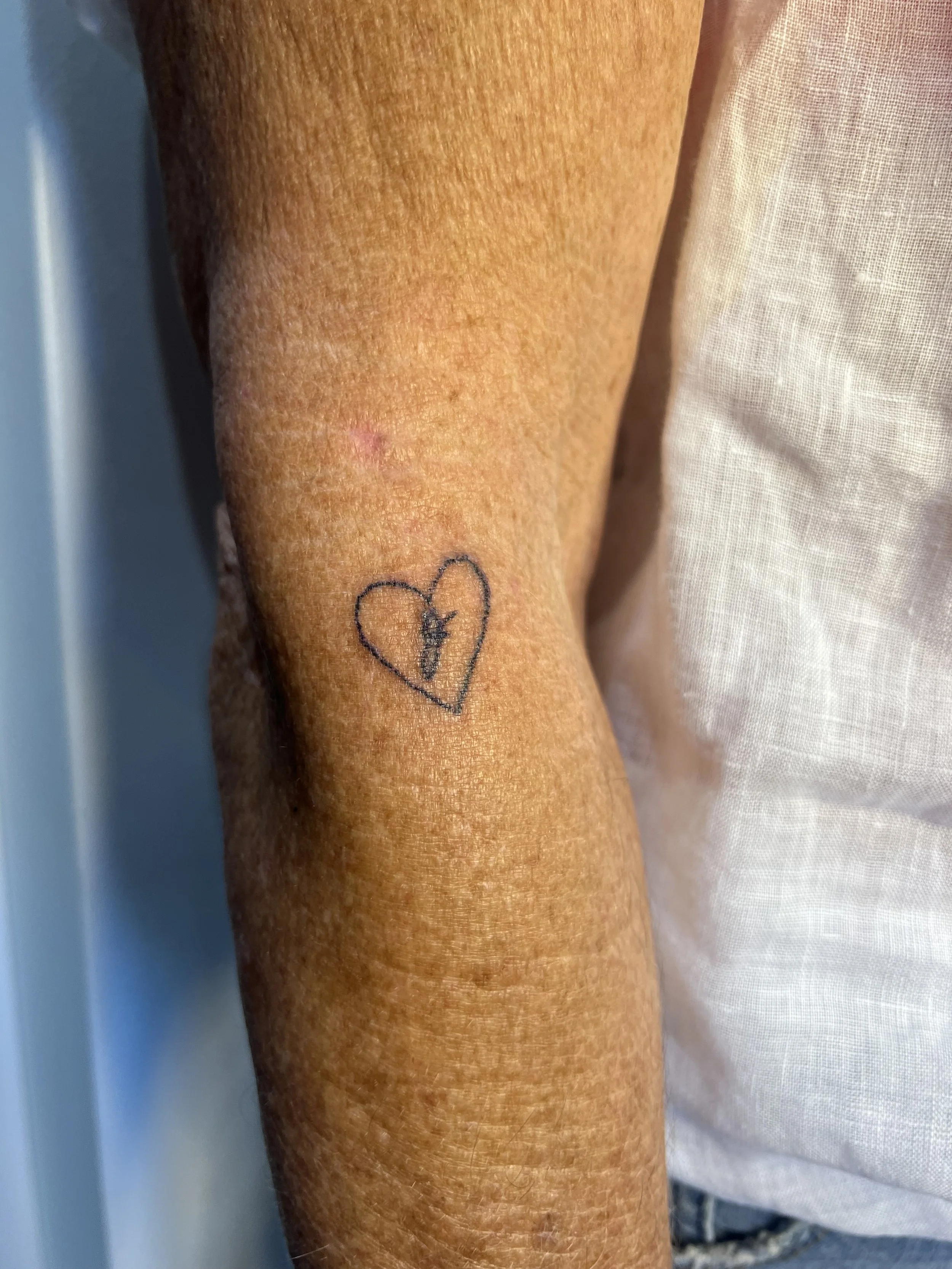 A close-up of a person's forearm showing a small heart-shaped tattoo with a star inside, and some slight skin redness or irritation around the tattoo.