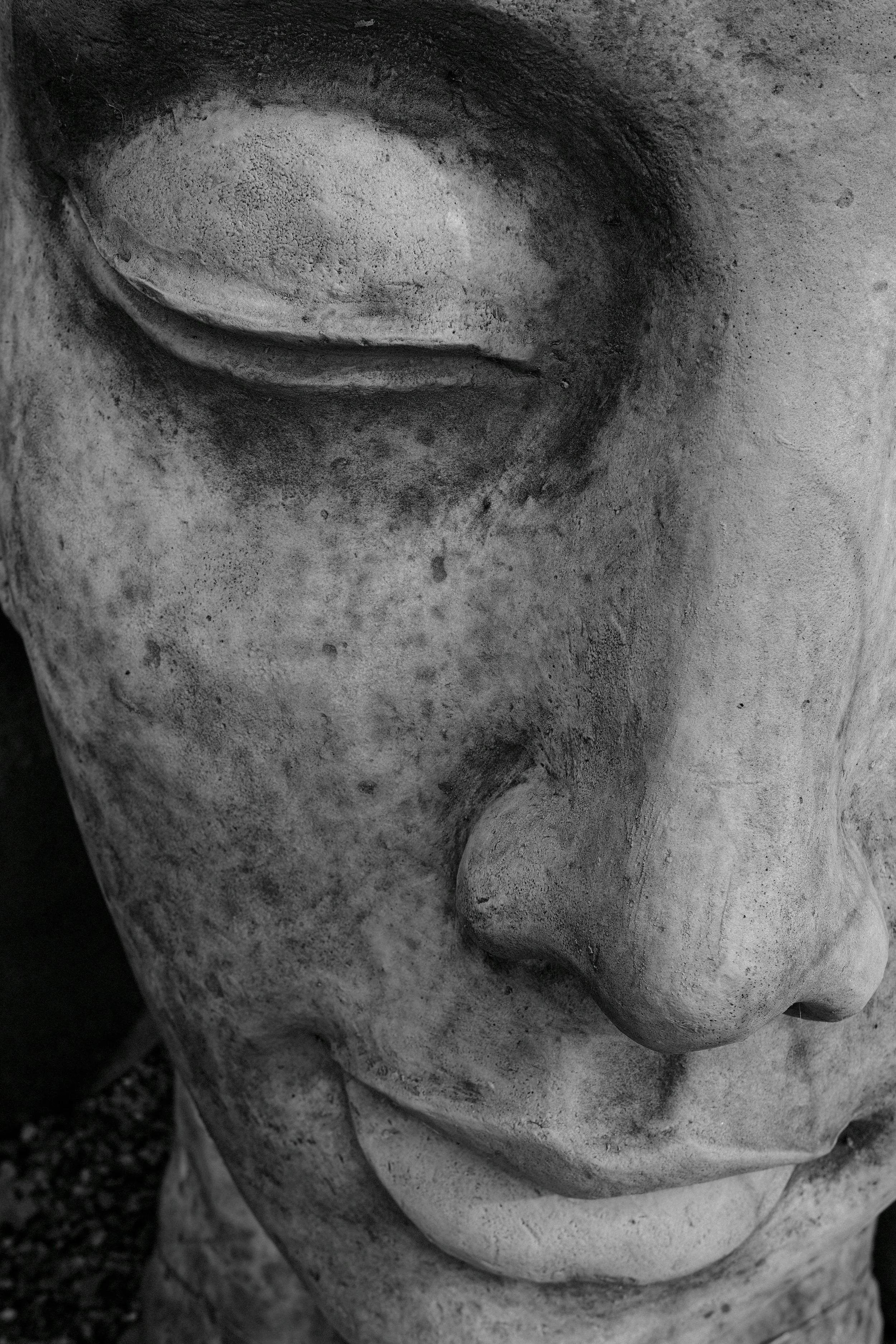 What Are Real Diseases That Cause Skin to Harden Like Stone?