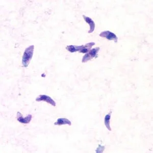 A close-up view of the Toxoplasma gondii underneath a microscope
