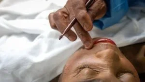 A close-up image of a deceased woman being prepared after an embalming