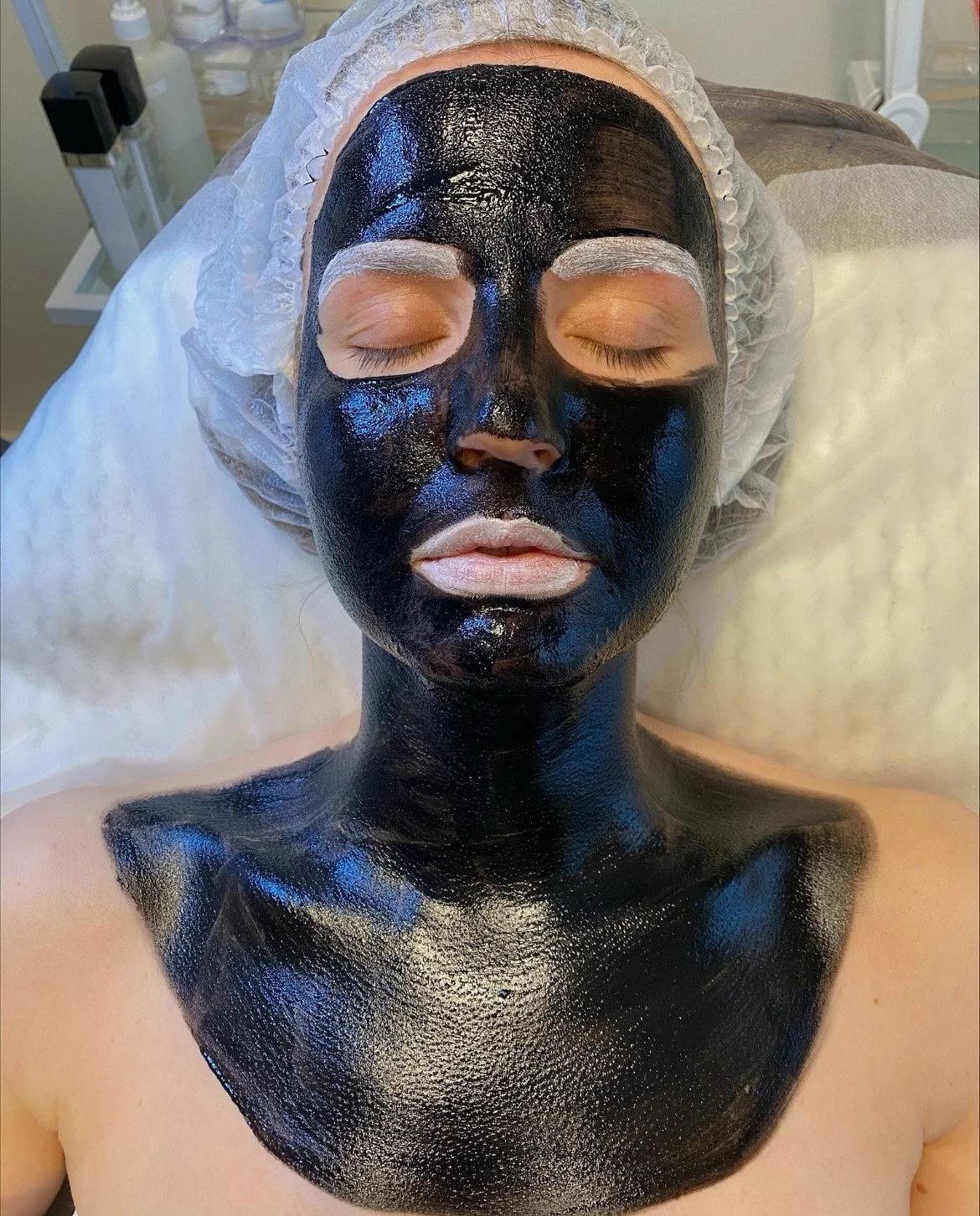 Hollywood peel