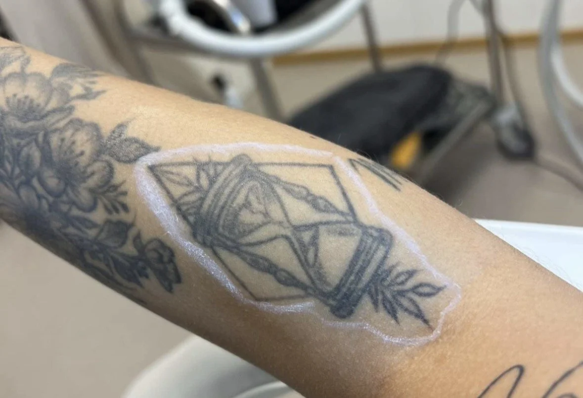 Tatovering av et kortstokk-symbol på en persons arm, omringet av en hvit markering og andre tatoveringer.