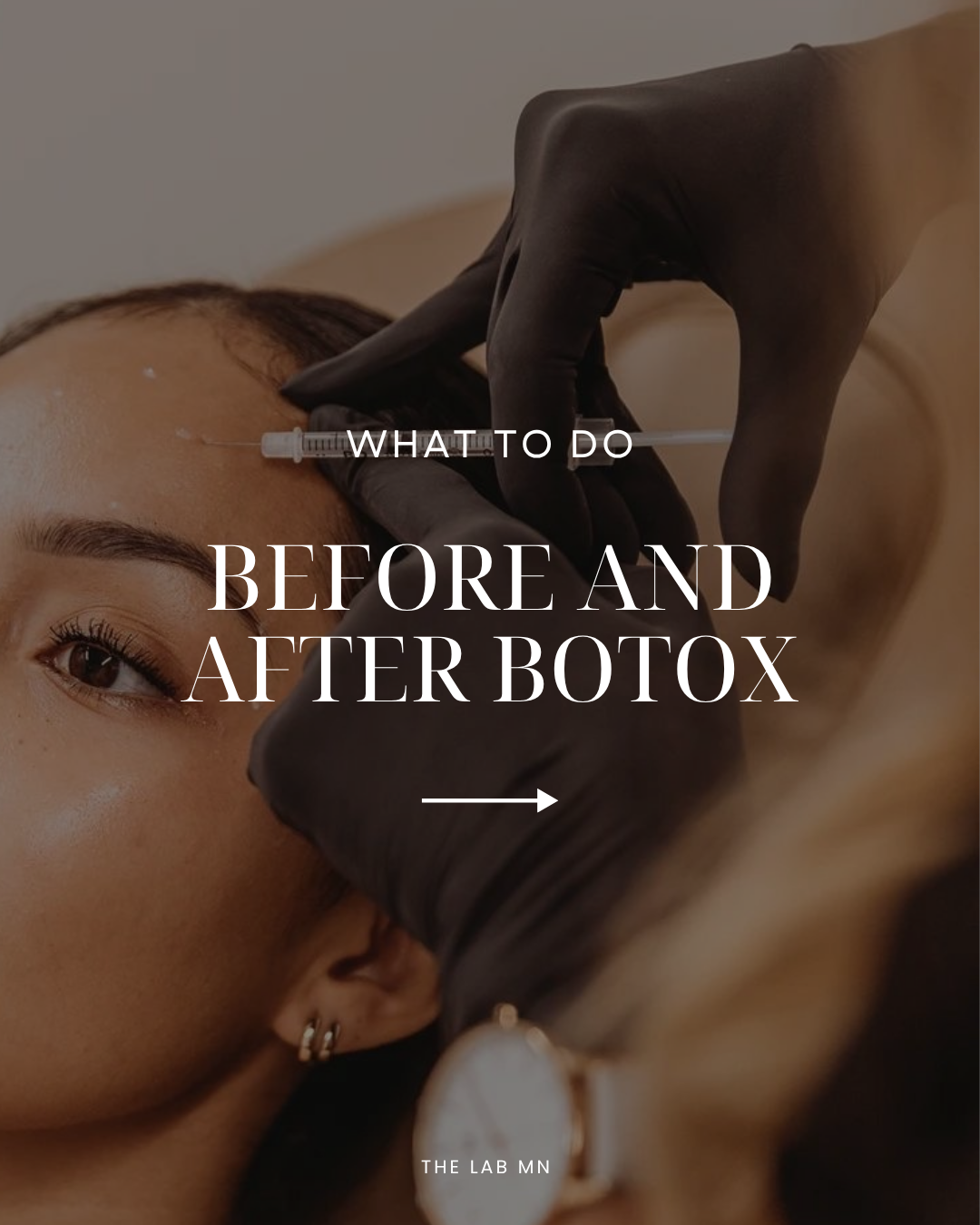 A woman receiving Botox injection on her forehead from a medical professional wearing black gloves.