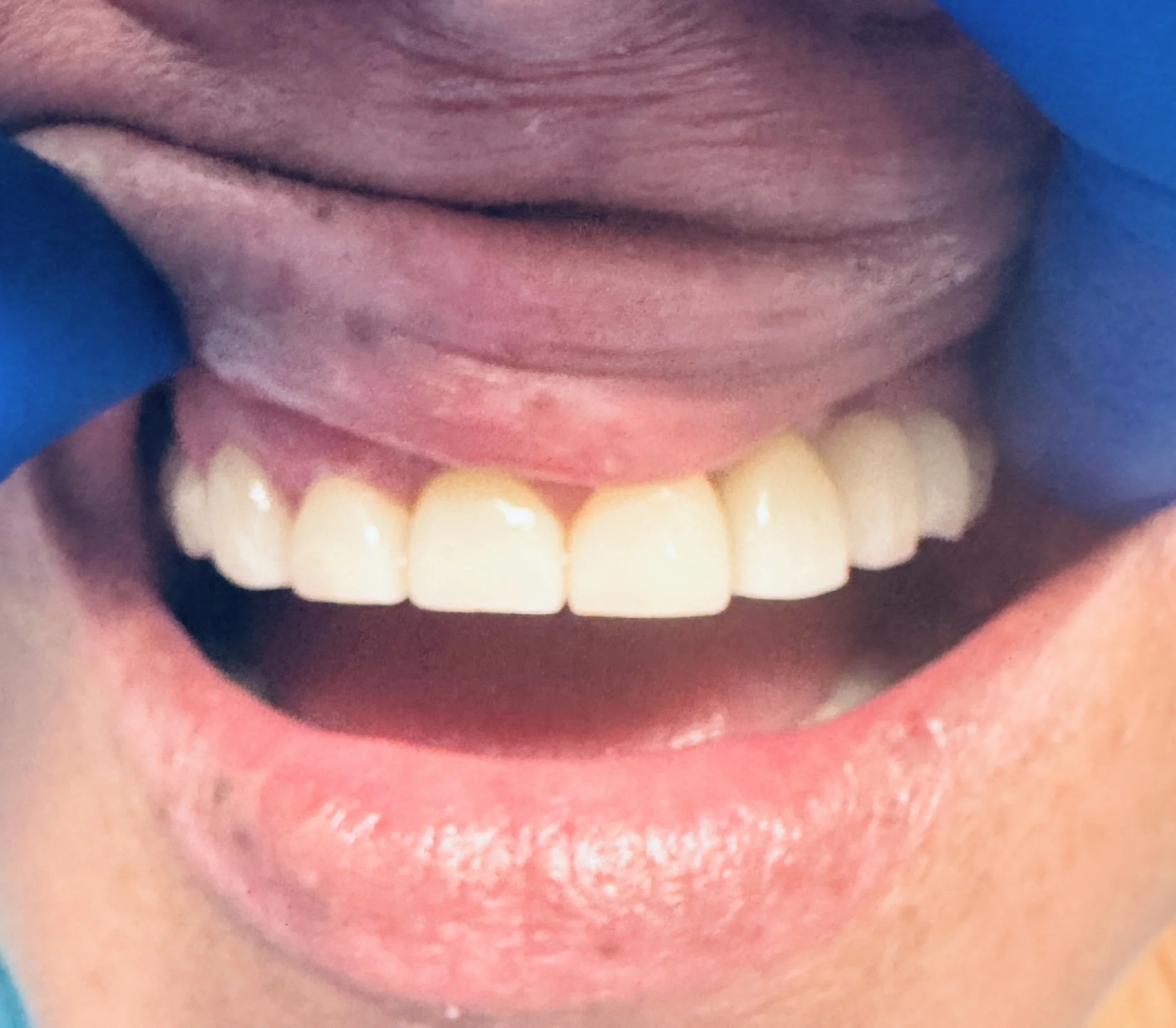 Close-up of a person's smiling mouth, showing white teeth and pink lips.