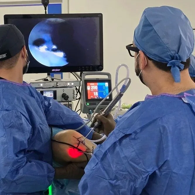 Artroscopia de rodilla: el Dr. Israel Romo y su equipo trabajan con la imagen de la cámara en el monitor