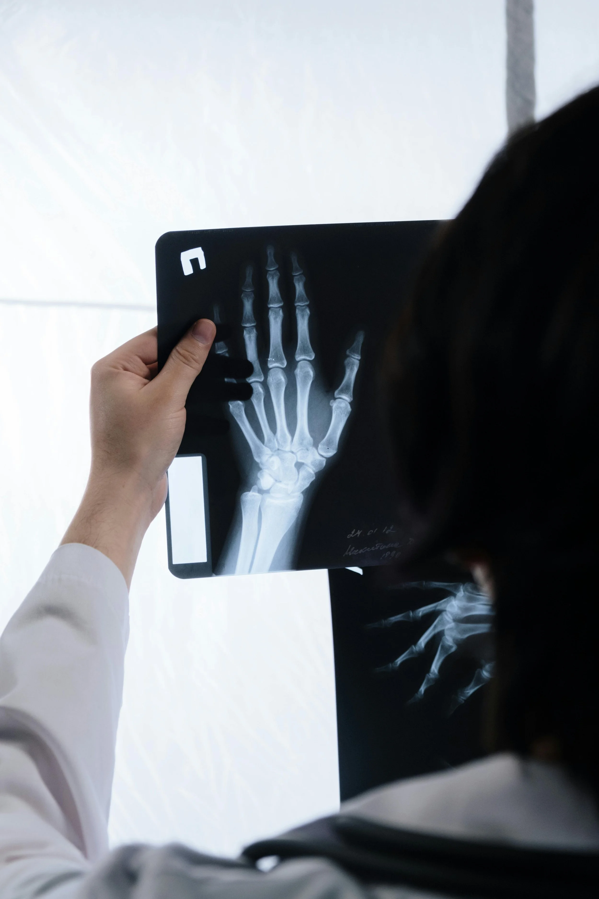 Médico revisando una radiografía de una mano