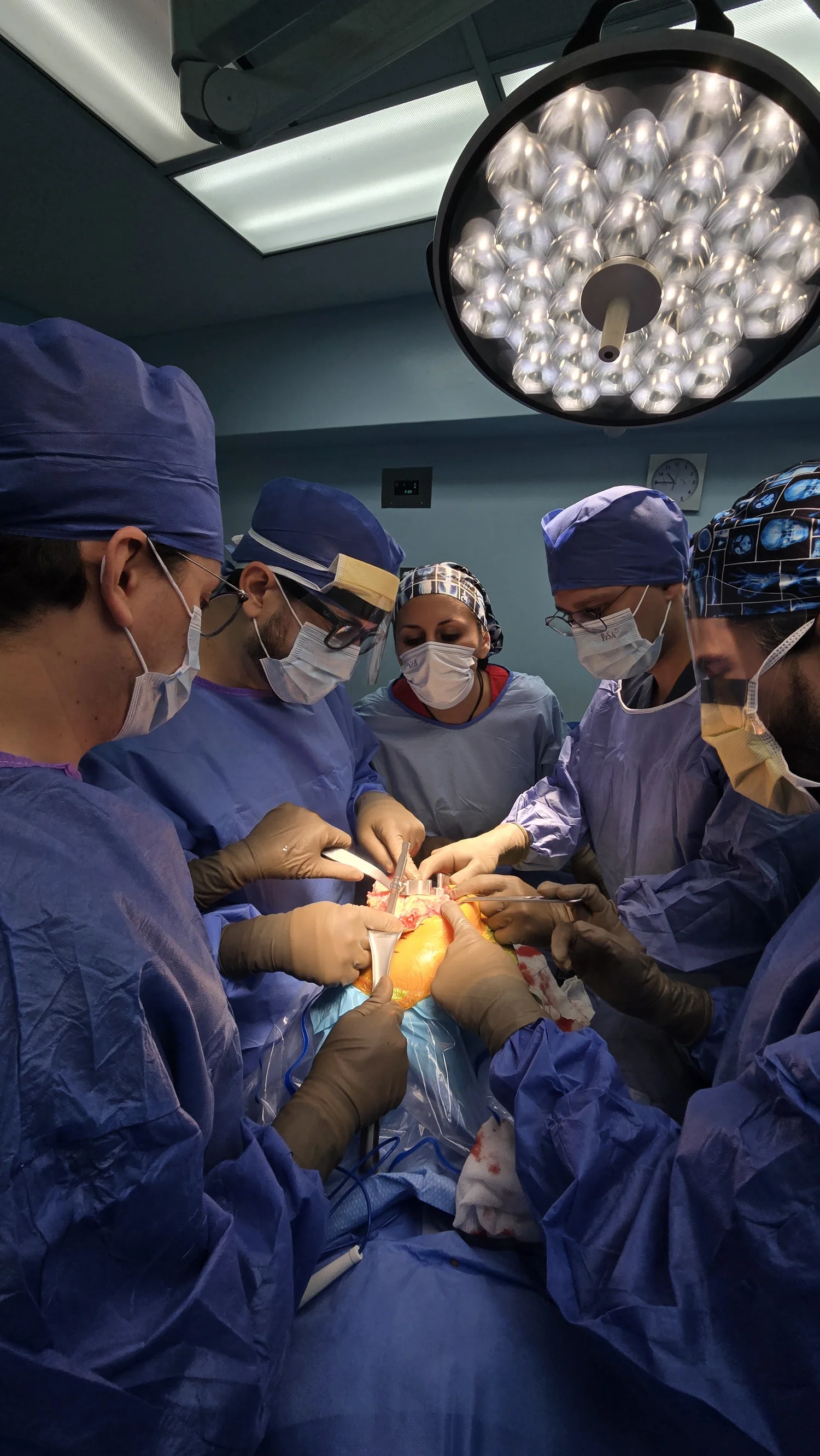 Equipo del Dr. Israel Romo en quirófano durante una cirugía de prótesis de rodilla