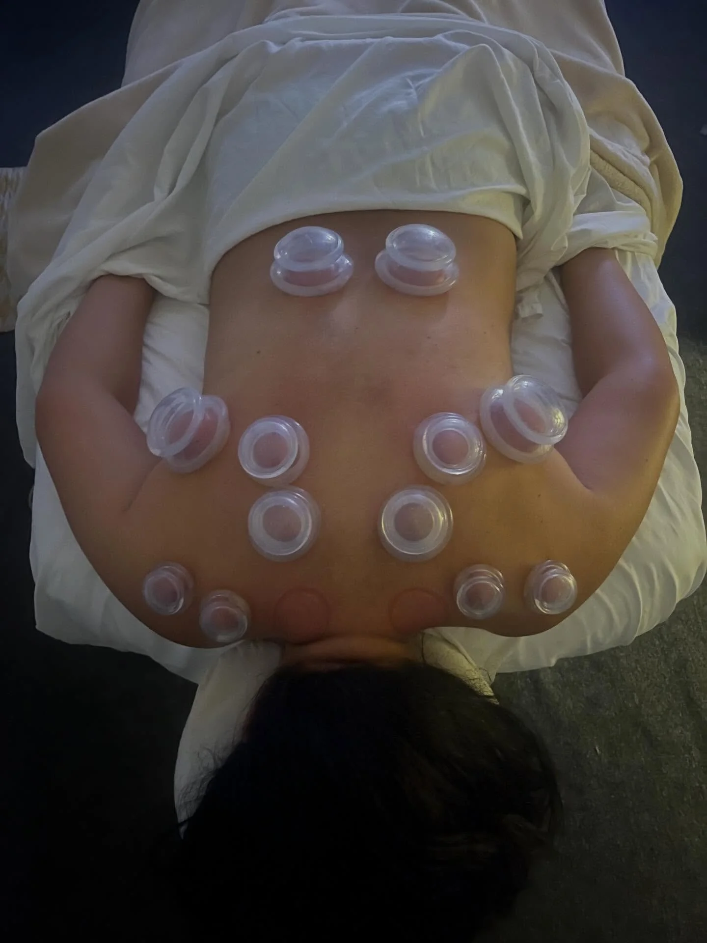 🌿 Spring Reset with Cupping Therapy 🌿

Out with the old, in with the new &mdash; spring is the perfect time to give your body the reset it&rsquo;s been craving. 🌸

Cupping therapy helps stimulate circulation, release deep muscle tension, and suppo