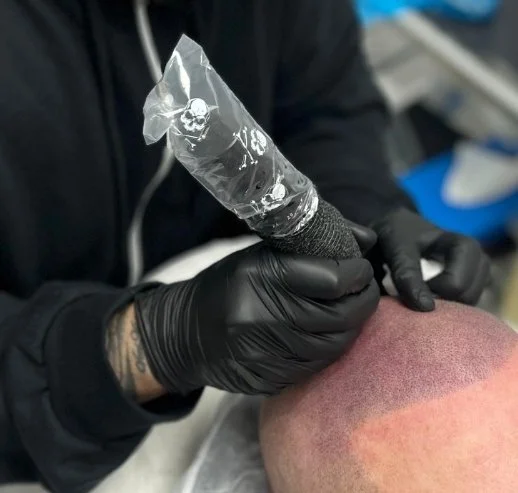 Person wearing black gloves using a tattoo machine on a person's scalp.