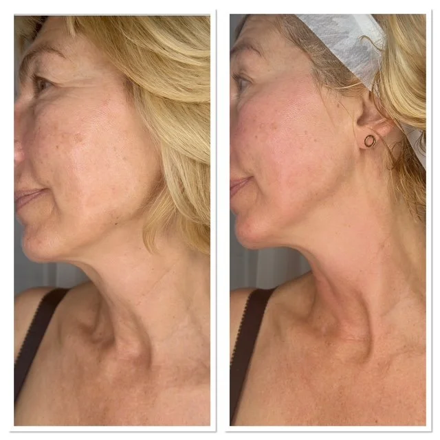 Advanced skin and aesthetic treatments tailored to long-term skin health in Horley, Surrey