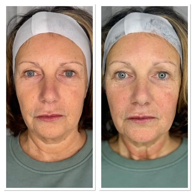 Advanced skincare clinic in Horley, Surrey