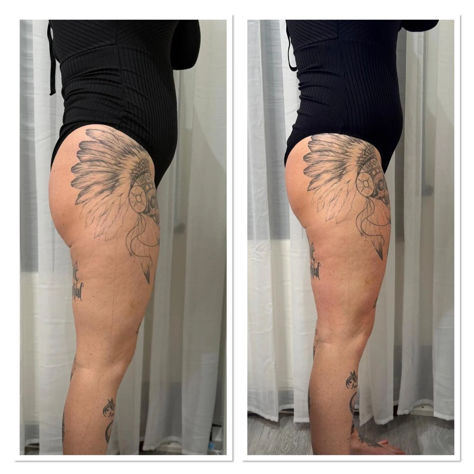 Advanced aesthetics and skin treatments in Surrey