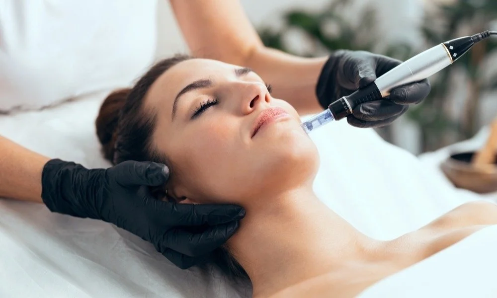 Microneedling treatment at Soulful Skin
