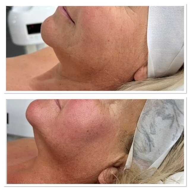 Natural healthy-looking skin results at Soulful Skin