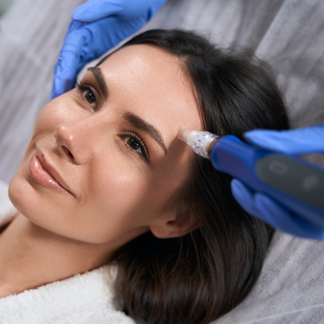 Medspa in Oceanside, CA, 92057 | SkinPen Microneedling Near Me