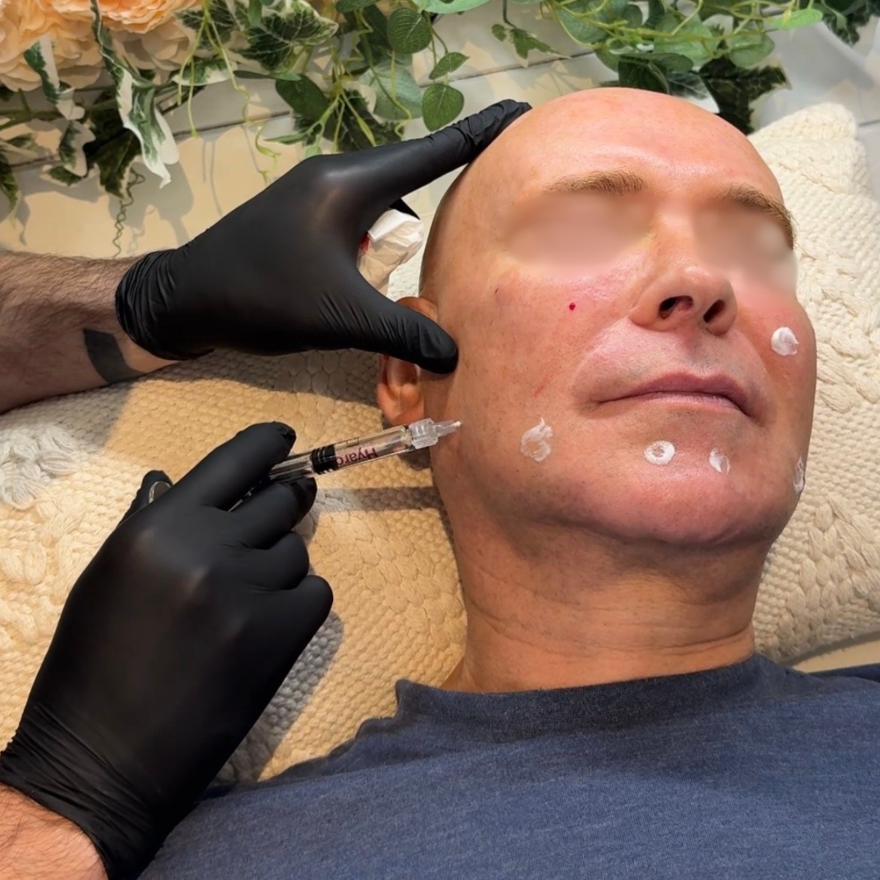 SkinBoosters