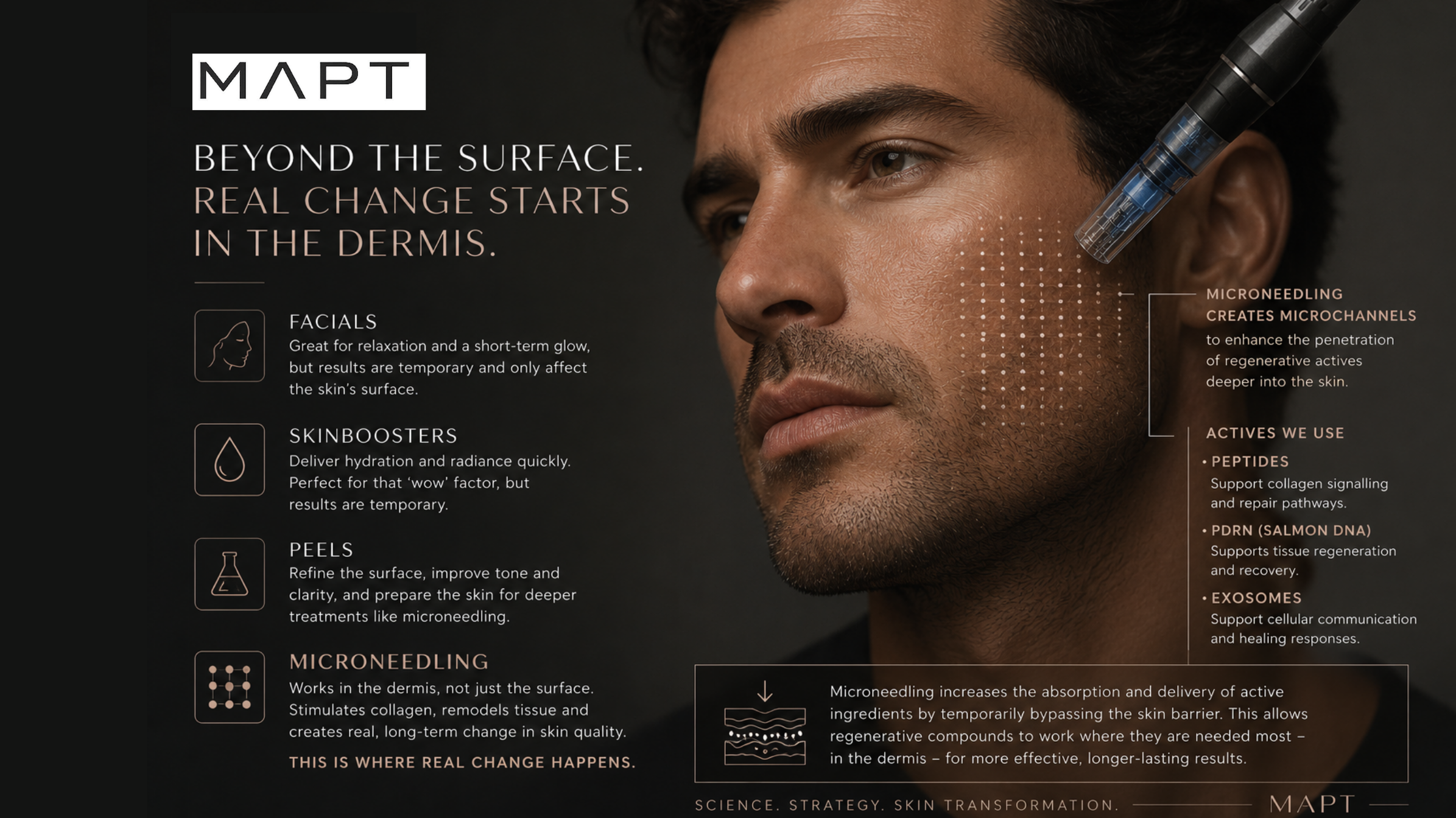 image of a male and microneedling device with text about treatments