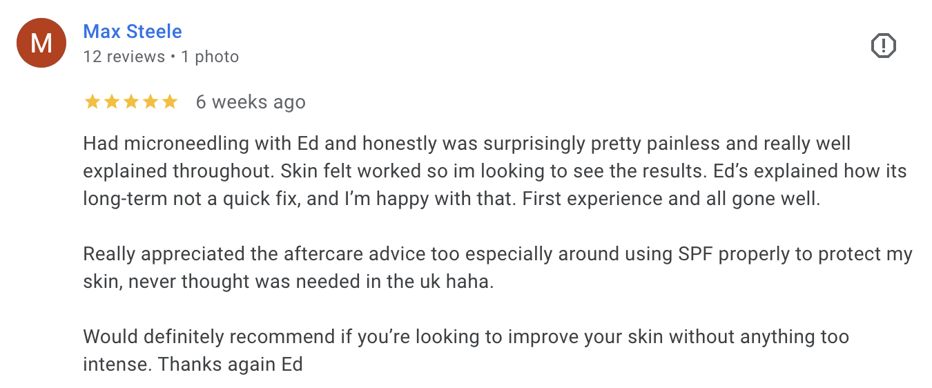 Screenshot of a Google review for a skincare treatment, mentioning microneedling with Ed, positive results, skincare advice, and recommendation.