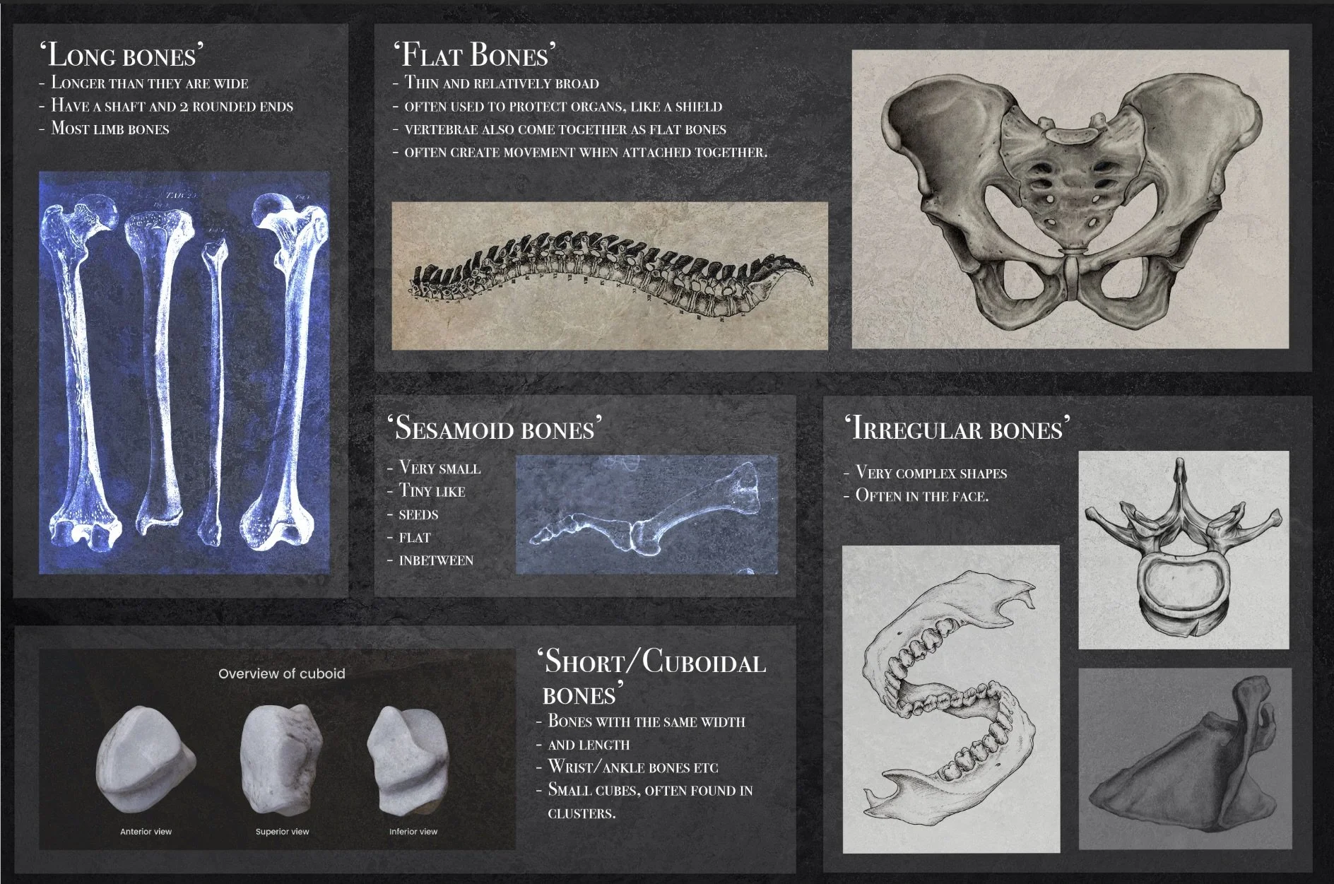 'Types of bone' research board. A part of the research/ideation process leading to a Halloween window display design based on bones and anatomy. 