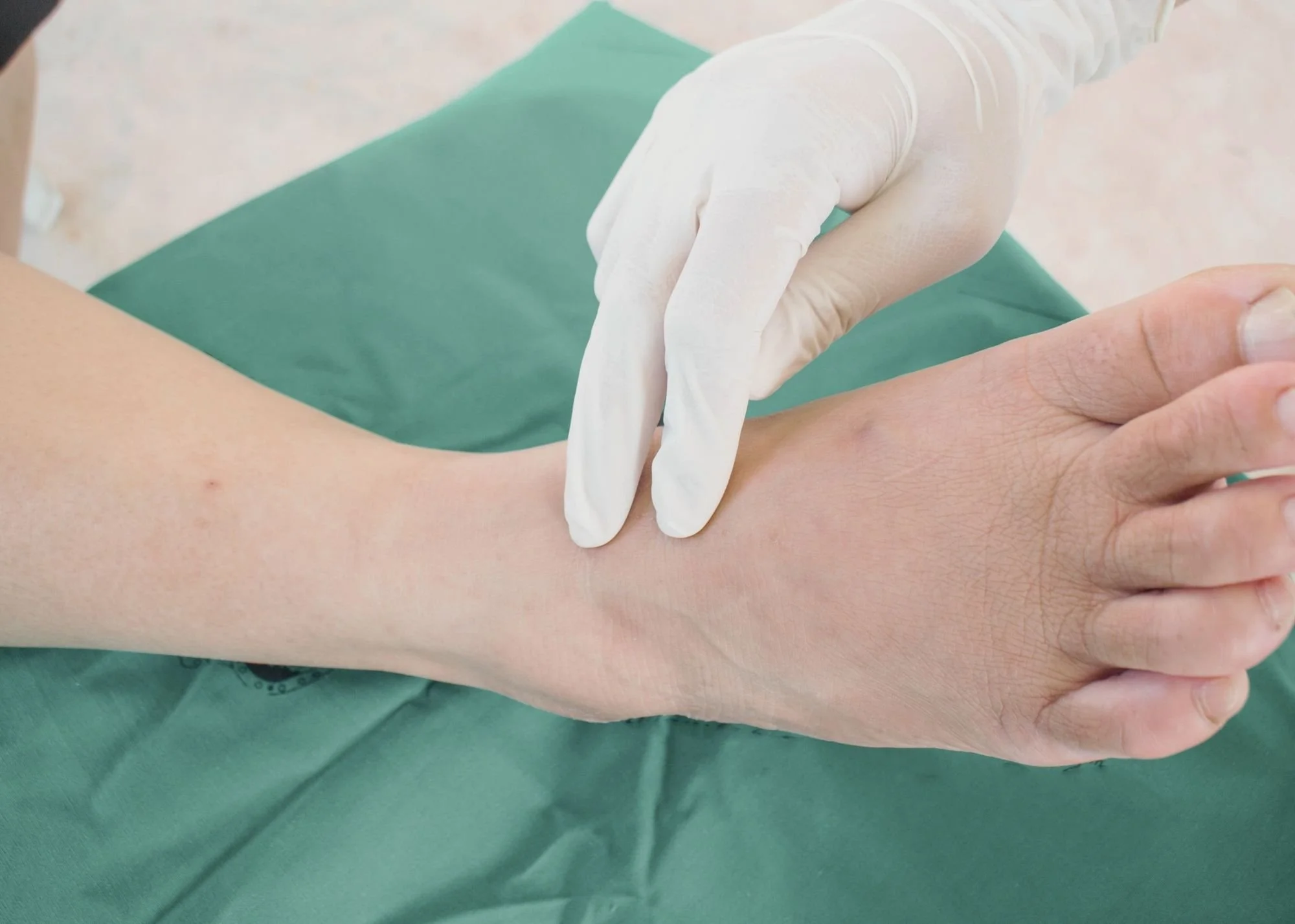 A healthcare professional wearing a white glove is performing an intradermal injection on a person's forearm.