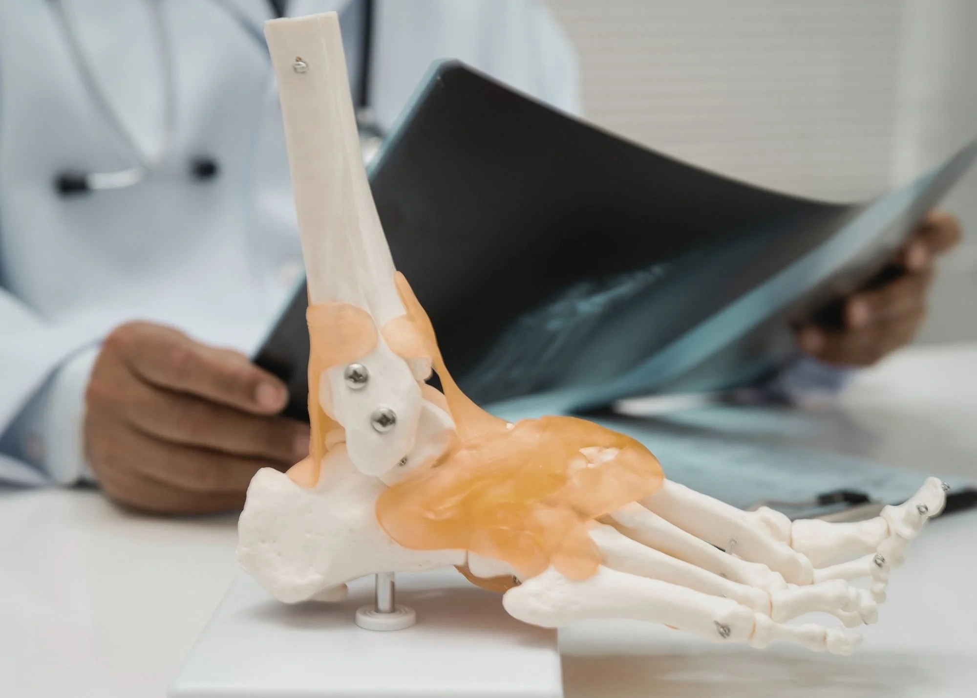 A medical model of a human pelvis and lower spine with a prosthetic implant and screws, held by a person in a white coat.