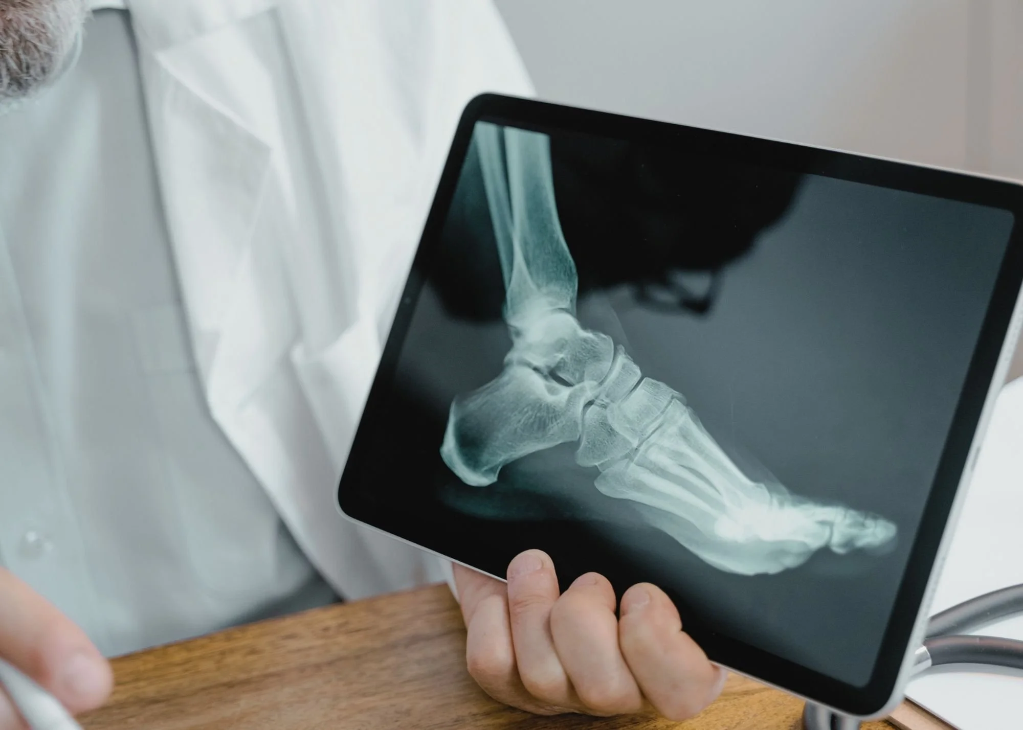 A person holding a tablet displaying an X-ray image of a foot and ankle.