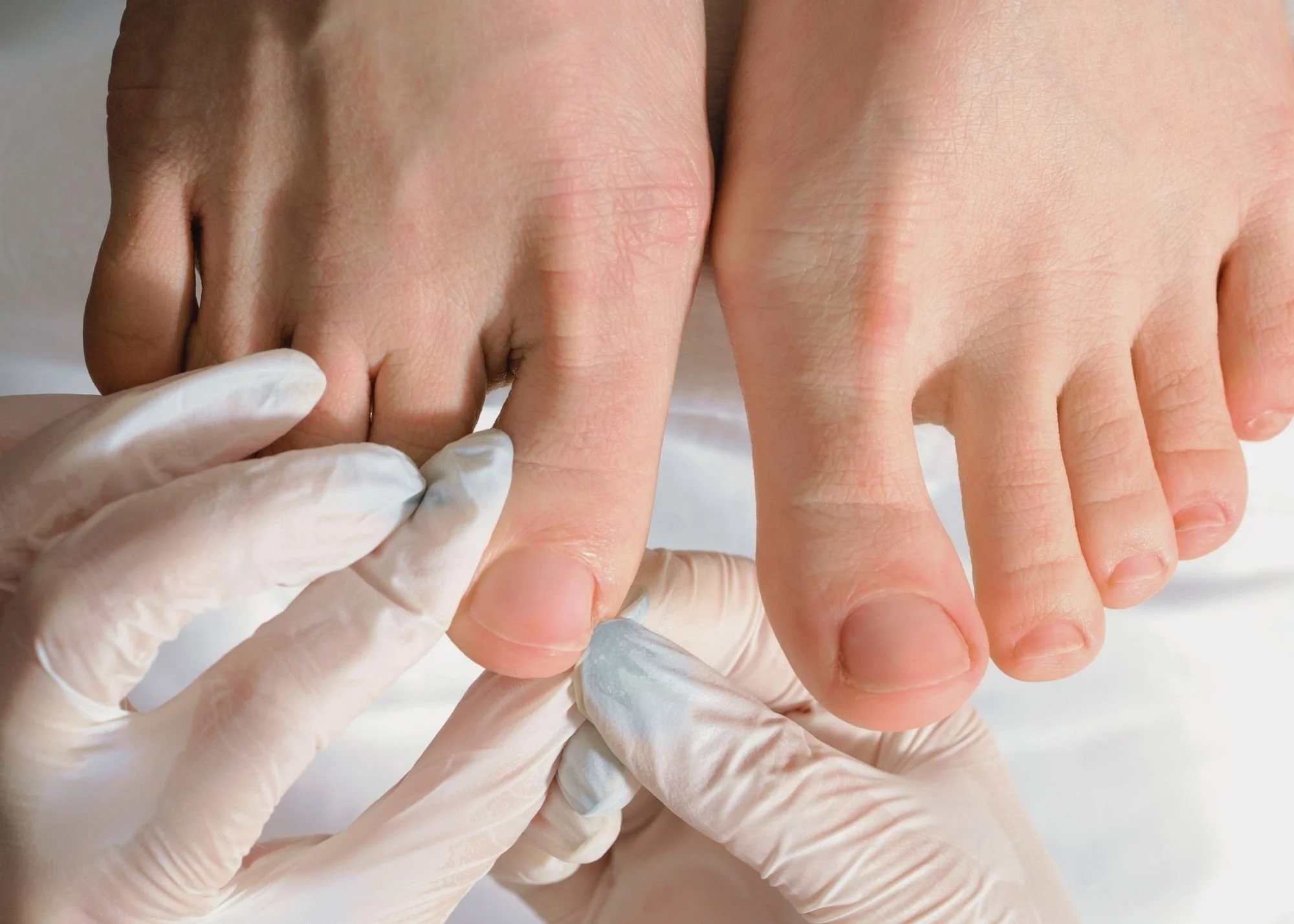Close-up of a hand with a ring being examined by a medical professional wearing gloves.