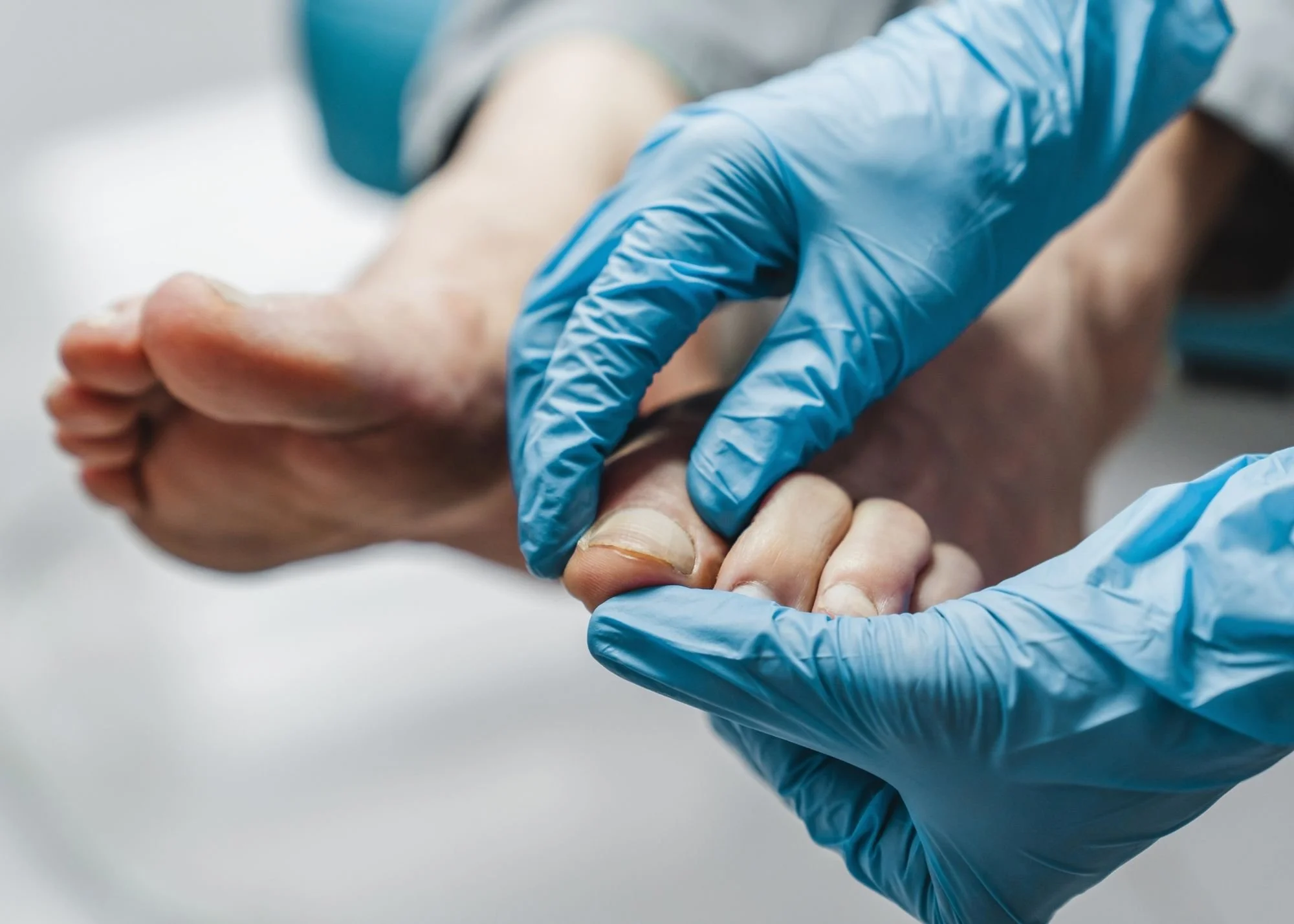 Close-up of a healthcare worker's gloved hands examining a patient's hand or finger.