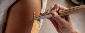 A person receiving a vaccination shot in their upper arm.