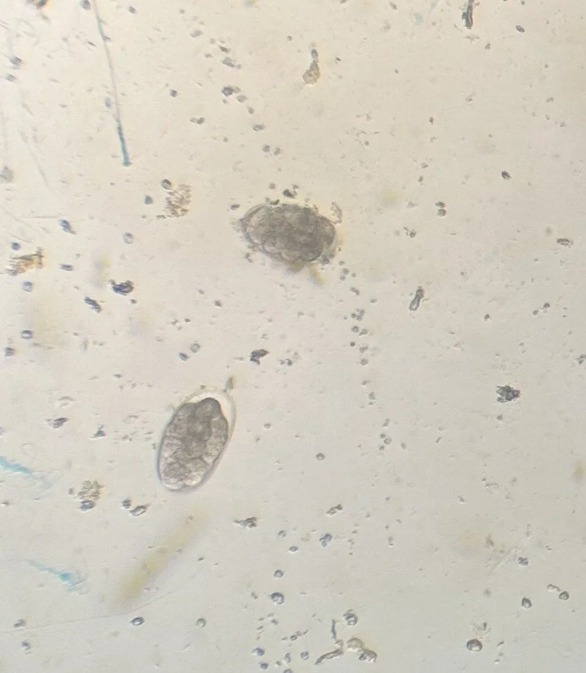 Microscopic view of numerous small microorganisms and two larger round organisms on a light background.