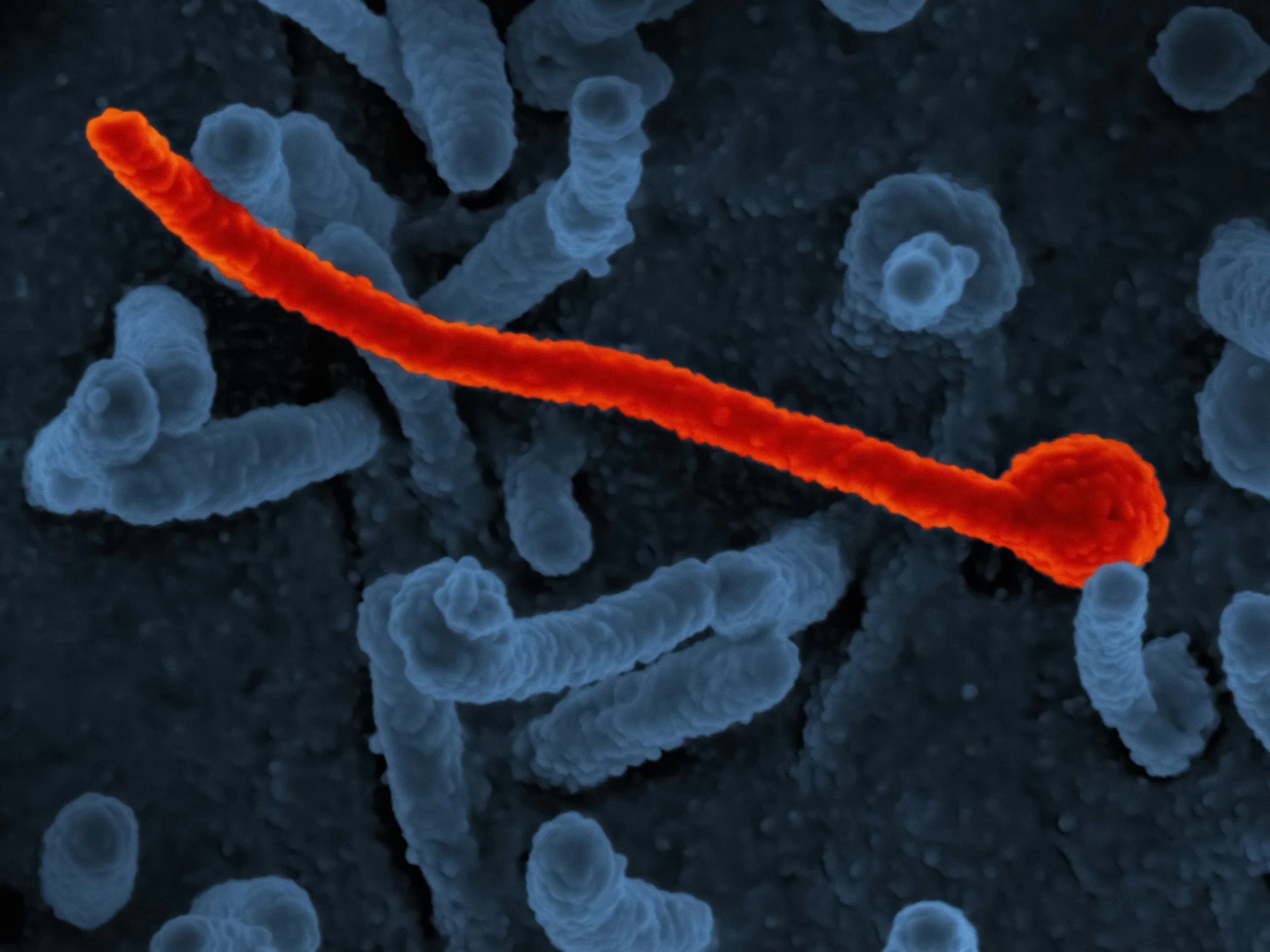 Predatory Microbes: Hunters, Hijackers, and Helpers
