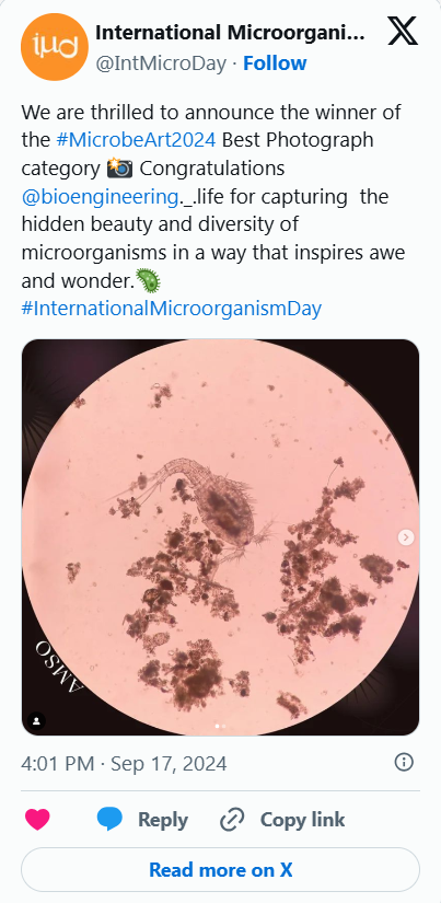 Microscopic view of a microorganism with a rounded body and hair-like structures, surrounded by smaller particles or organisms, seen through a pinkish background.