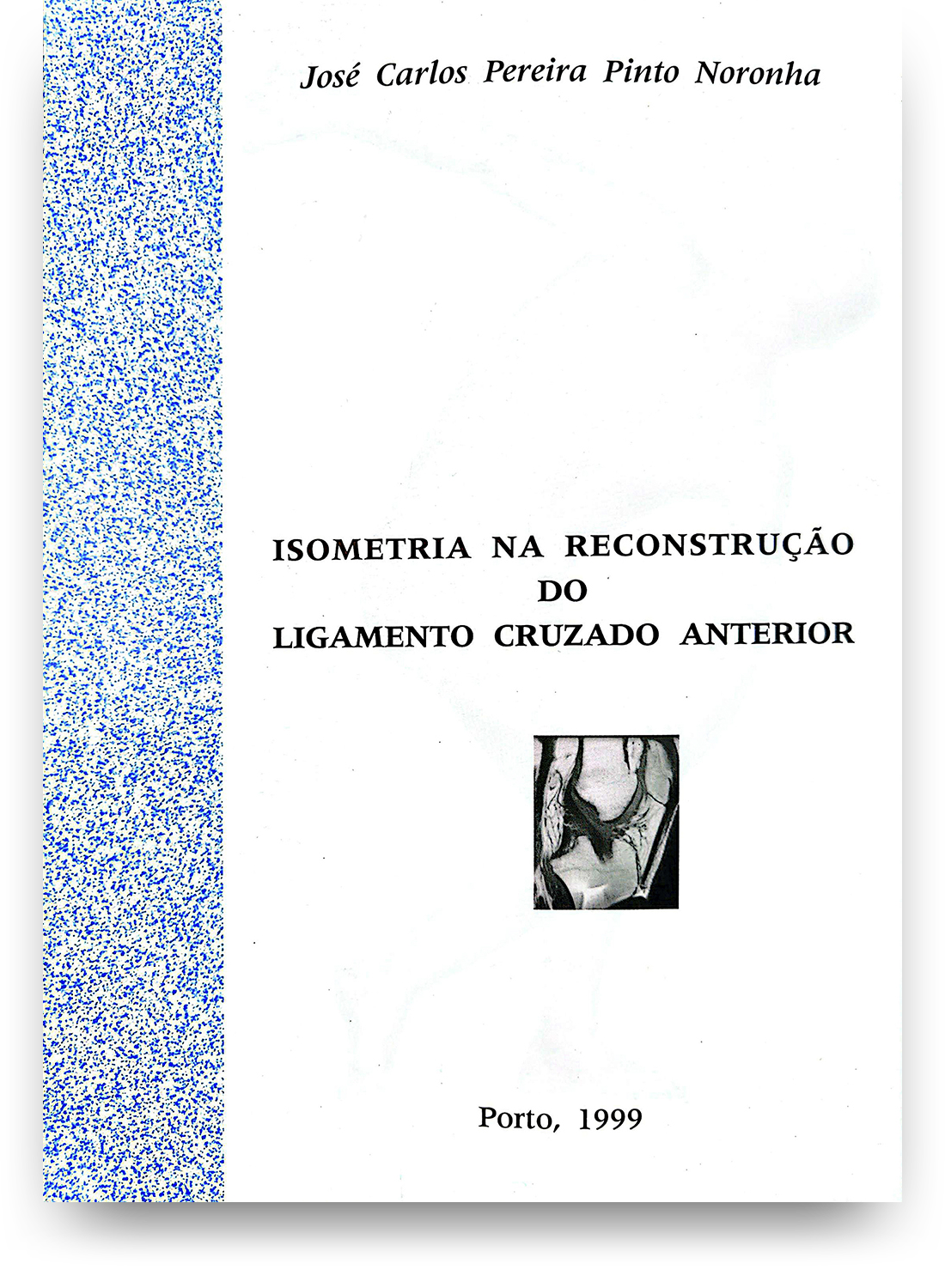 Capa de livro com título "Isometria na Reconstrução do Ligamento Cruzado Anterior" por José Carlos Pereira Pinto Noronha, com uma imagem de uma artrocentese e informações de localização e ano de publicação em Porto, 1999.