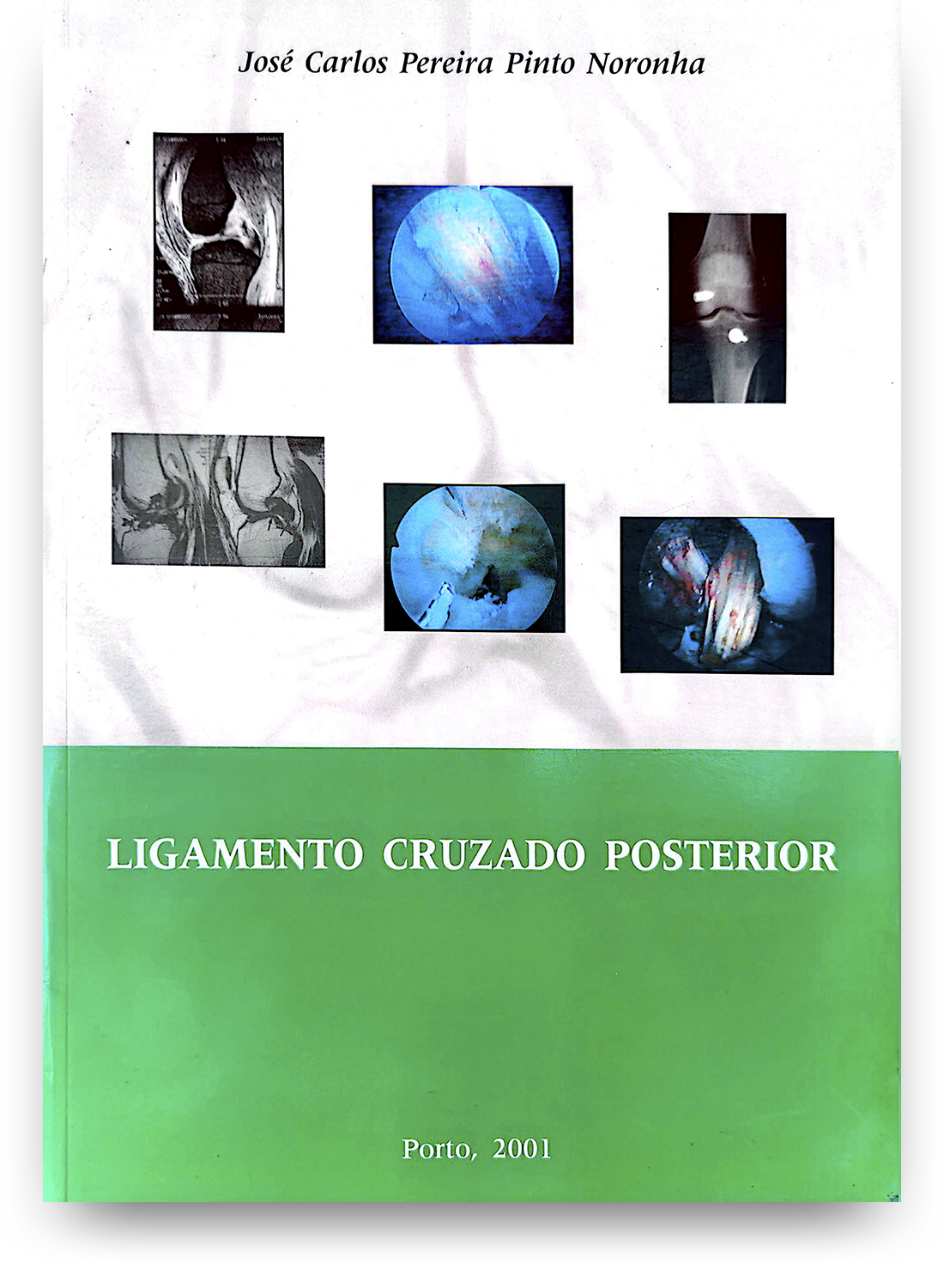 Capa de livro com o título 'Ligamento Cruzado Posterior', autor José Carlos Pereira Pinto Noronha, com imagens médicas relacionadas ao joelho e ao ligamento cruzado posterior, publicado em Porto, 2001.