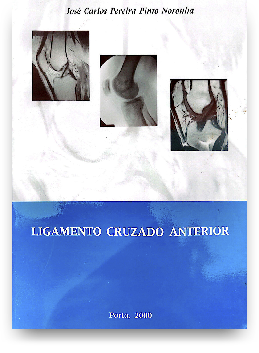 Capa de livro com título 'Ligamento Cruzado Anterior', autor 'José Carlos Pereira Pinto Noronha', publicado em Porto, 2000. A capa possui três imagens de ressonância magnética de joelhos.