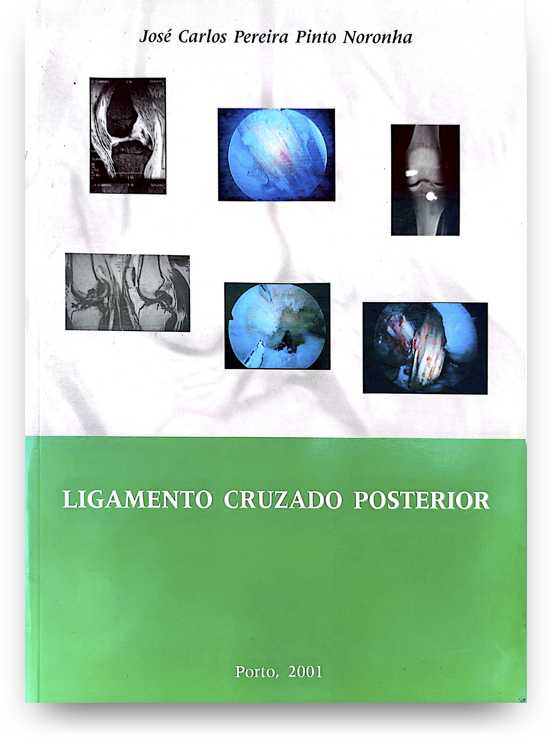 Capa de livro com título "Ligamento Cruzado Posterior" e várias imagens médicas de radiografias e cirurgias, com o autor José Carlos Pereira Pinto Noronha e a cidade Porto, 2001.